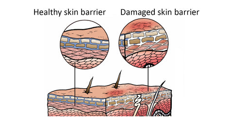 damaged skin